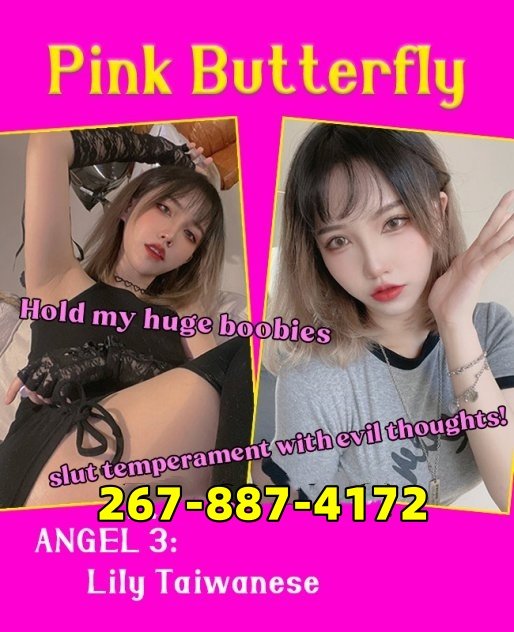 💋💦🔴🟨267-887-4172🟨🟨💋💦🔴 Escorts Philadelphia
